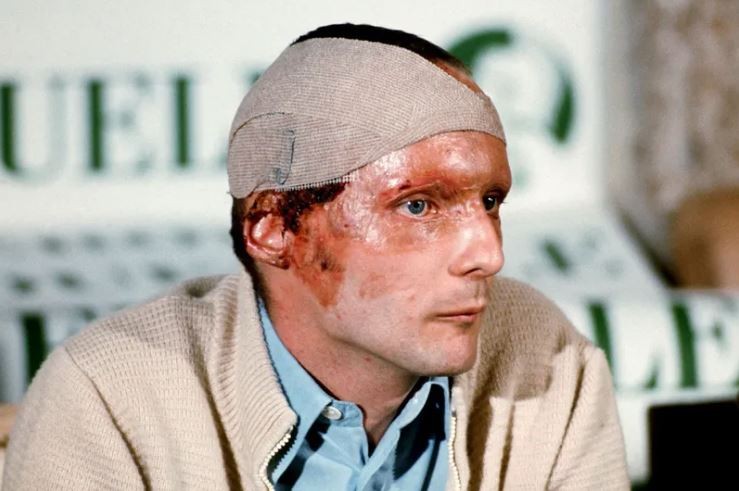 lauda-injuries.JPG