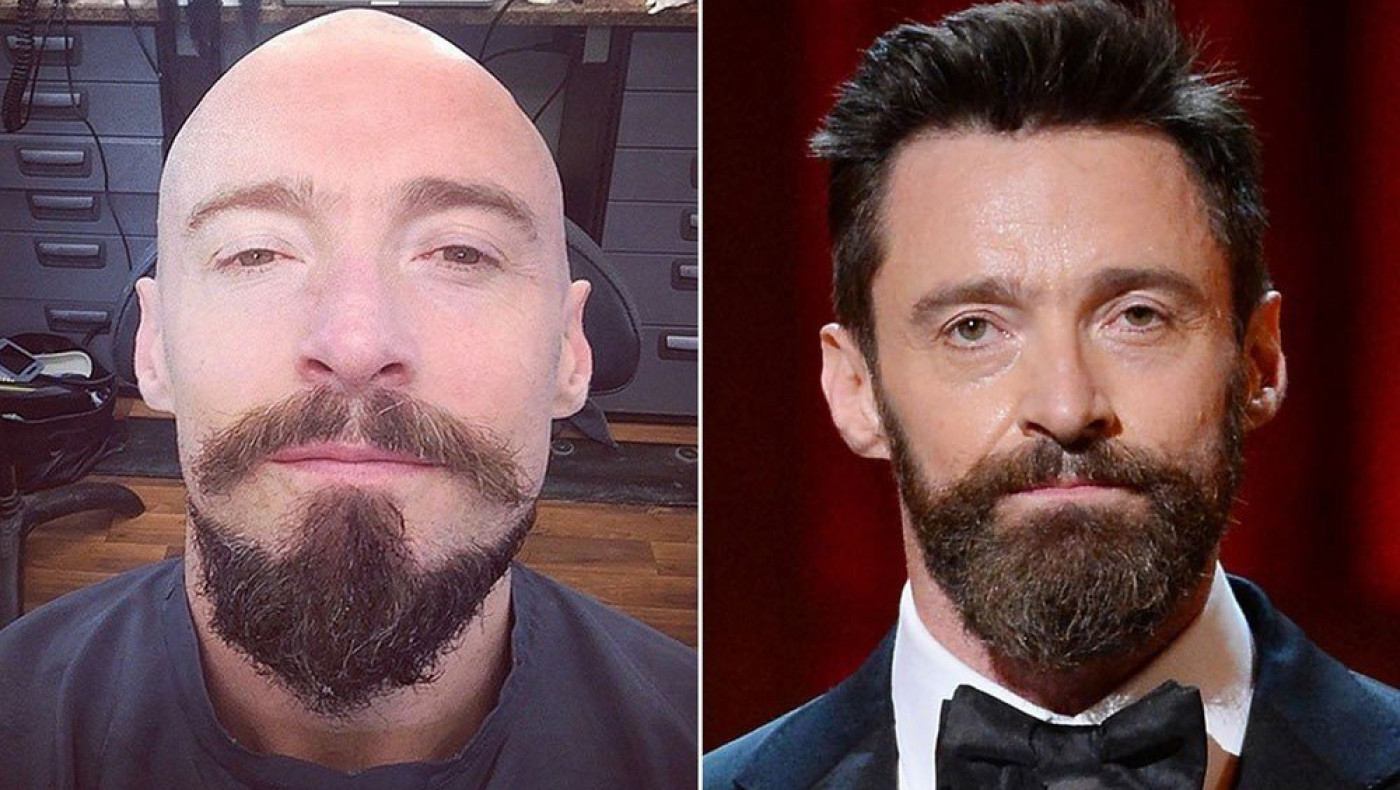 «Καράφλιασε» ο Hugh Jackman! 