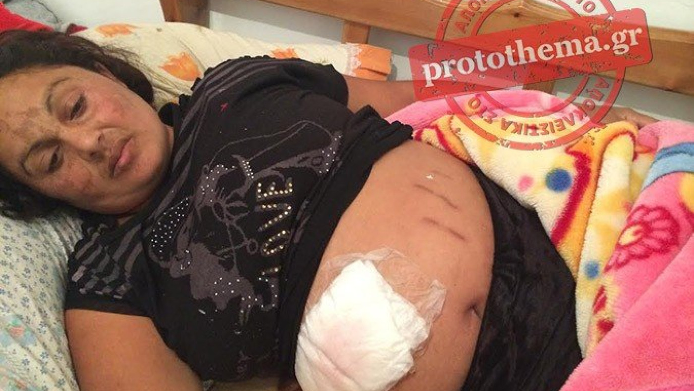 Σοκ στα Πατήσια: Ληστές μαχαίρωσαν έγκυο στην κοιλιά