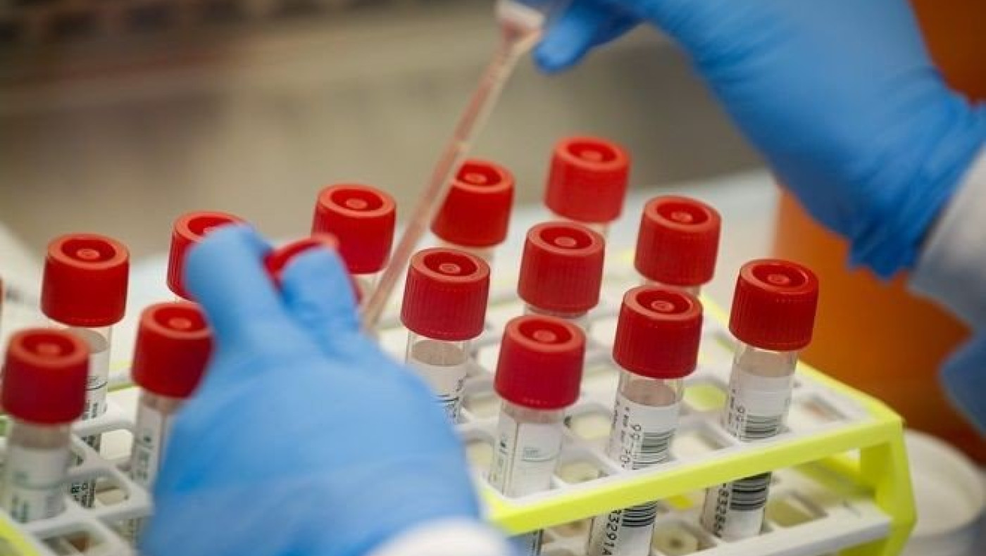 Κορονοϊός και εμβόλιο: Πού βρισκόμαστε σήμερα - Έρευνες ανά τον κόσμο