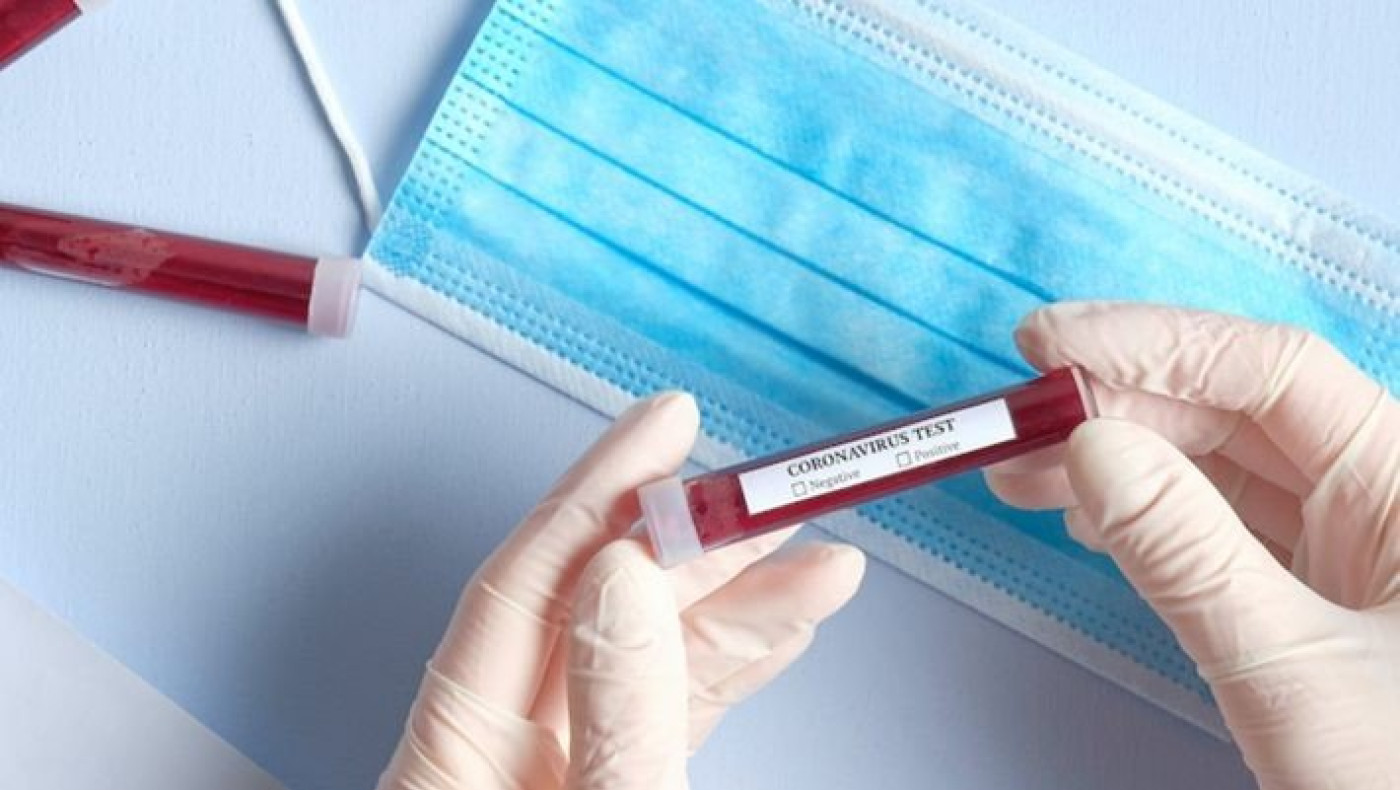 Κορωνοϊός: Ανακοινώθηκαν 354 νέα κρούσματα, 78 οι διασωληνωμένοι