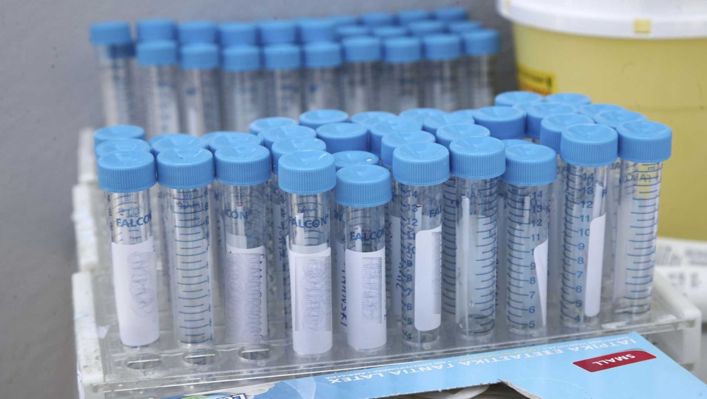 ΣΟΚ: 1259 νέα κρούσματα, 102 οι διασωληνωμένοι!