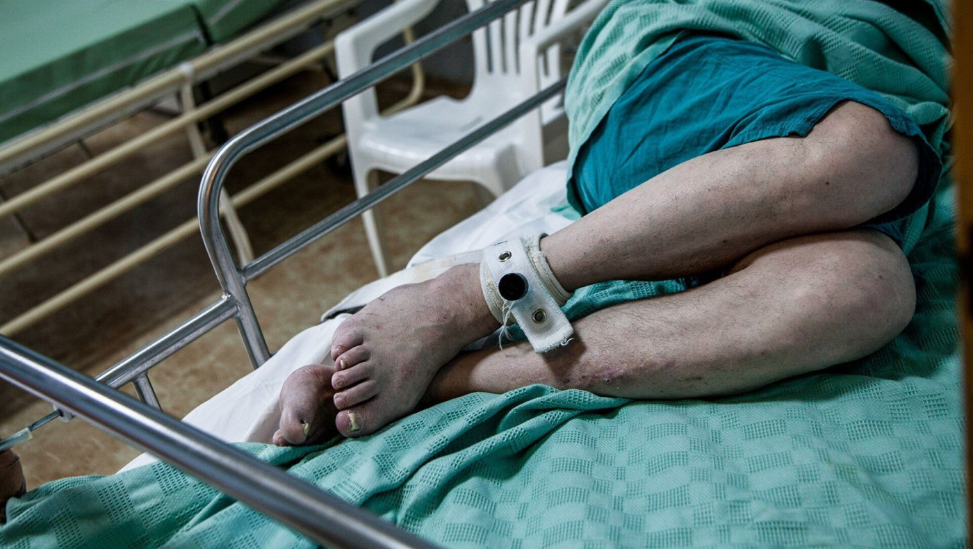 Μεγάλες ελλείψεις  στα ψυχιατρικά νοσοκομεία καταγγέλλουν οι εργαζόμενοι
