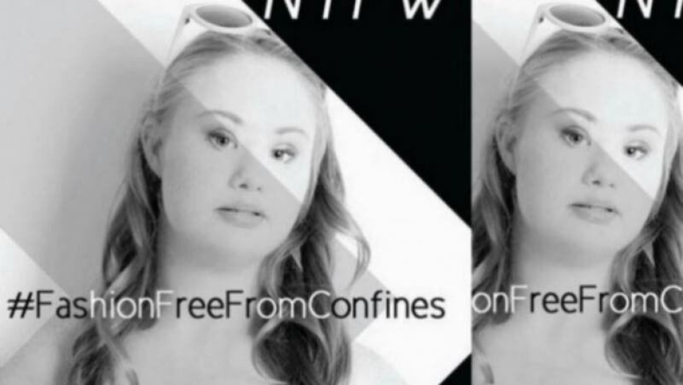 «Βουίζει» το διαδίκτυο για το νέο κορίτσι-μοντέλο με σύνδρομο Down 