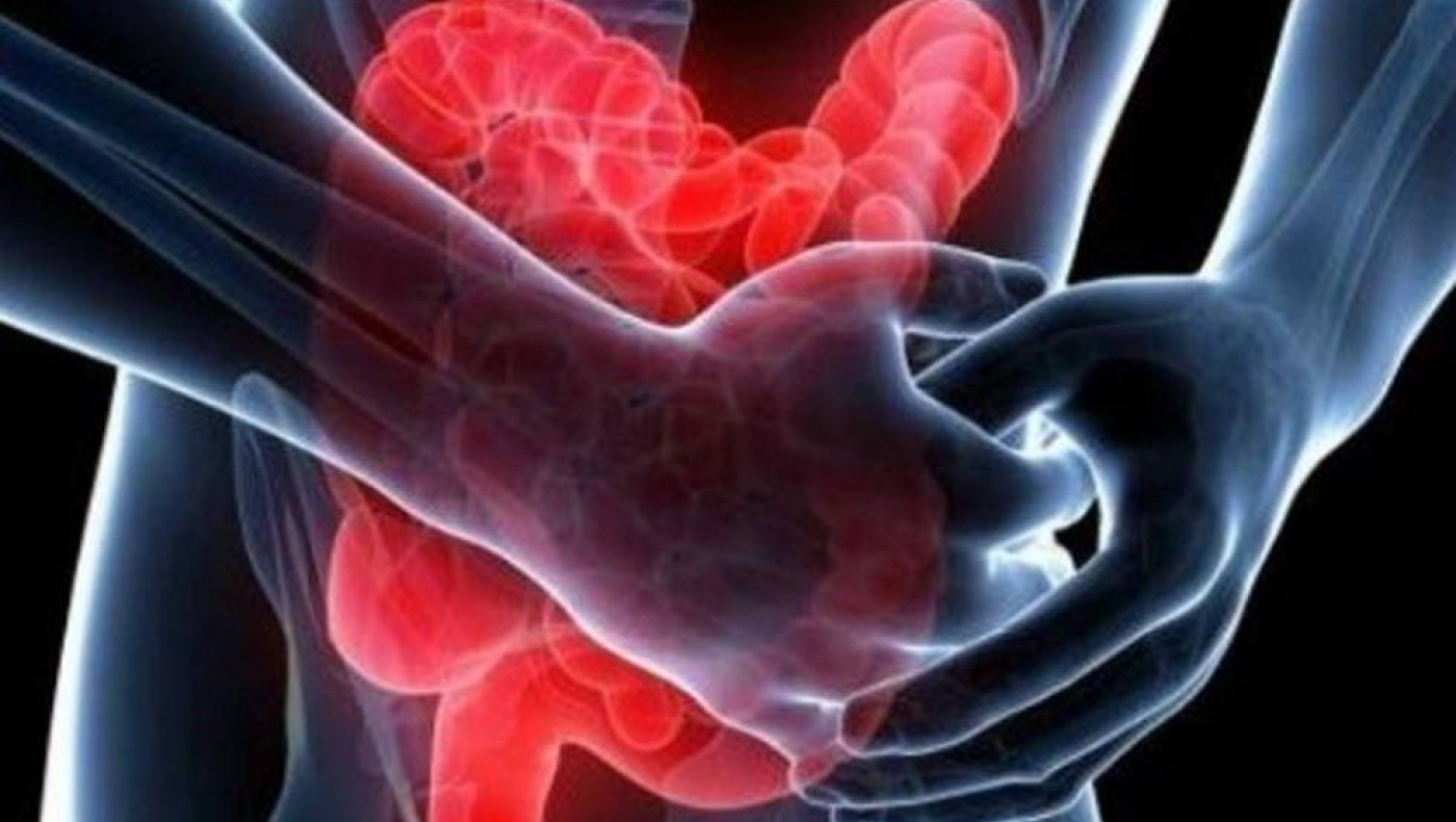 Ελκώδης κολίτιδα και νόσος του Crohn σε 65αρηδες: Τα χάπια που «φταίνε» ακόμη και κατά 96%