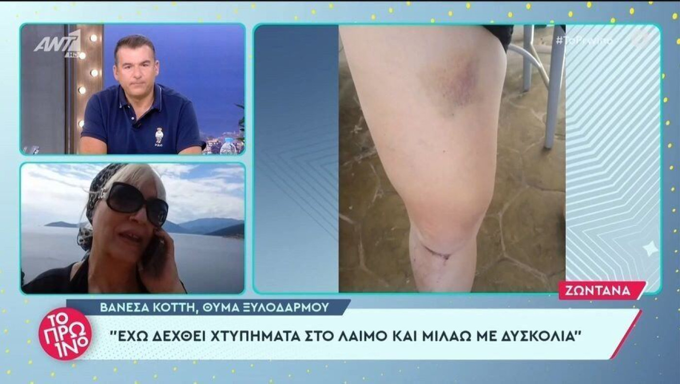 Βανέσα Κόττη: Κατήγγειλε ξυλοδαρμό η τρανς παίκτρια του Game of Chefs