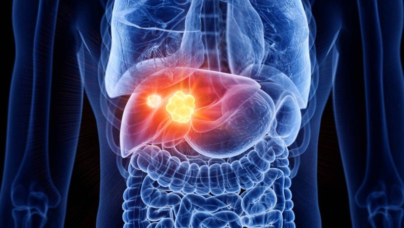 Ο «αόρατος» εχθρός του ήπατος-Οι επιπτώσεις για την υγεία μας