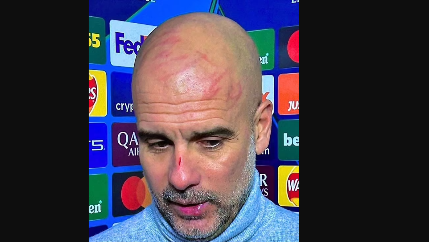 Πεπ Γκουαρδιόλα για τις γρατζουνιές: «Θέλω να βλάψω τον εαυτό μου»!