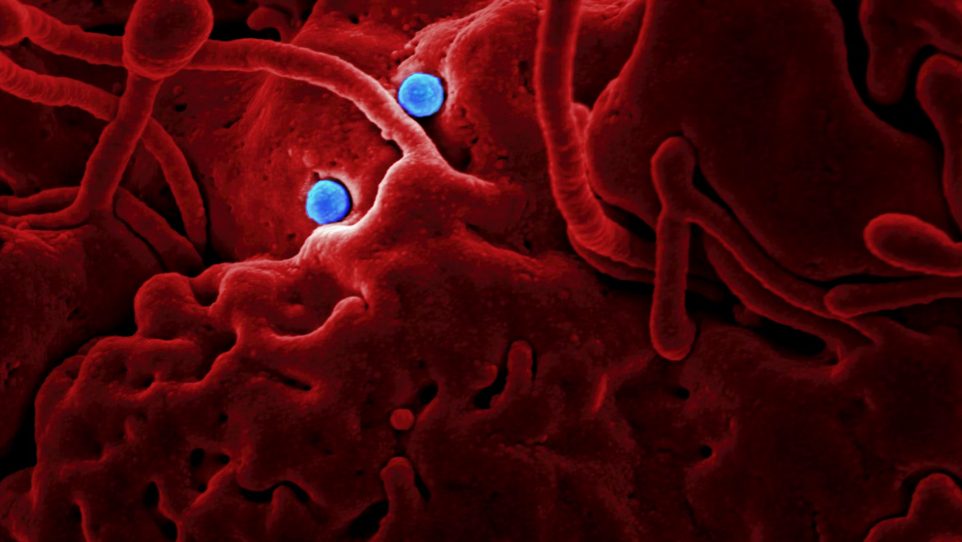 «Καμπανάκι» από ΠΟΥ για θανατηφόρα νόσο με ήδη 50 νεκρούς