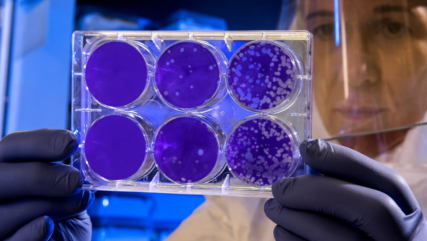 Aspergillus: Ποιος είναι ο μύκητας που «τρώει» το εσωτερικό μας