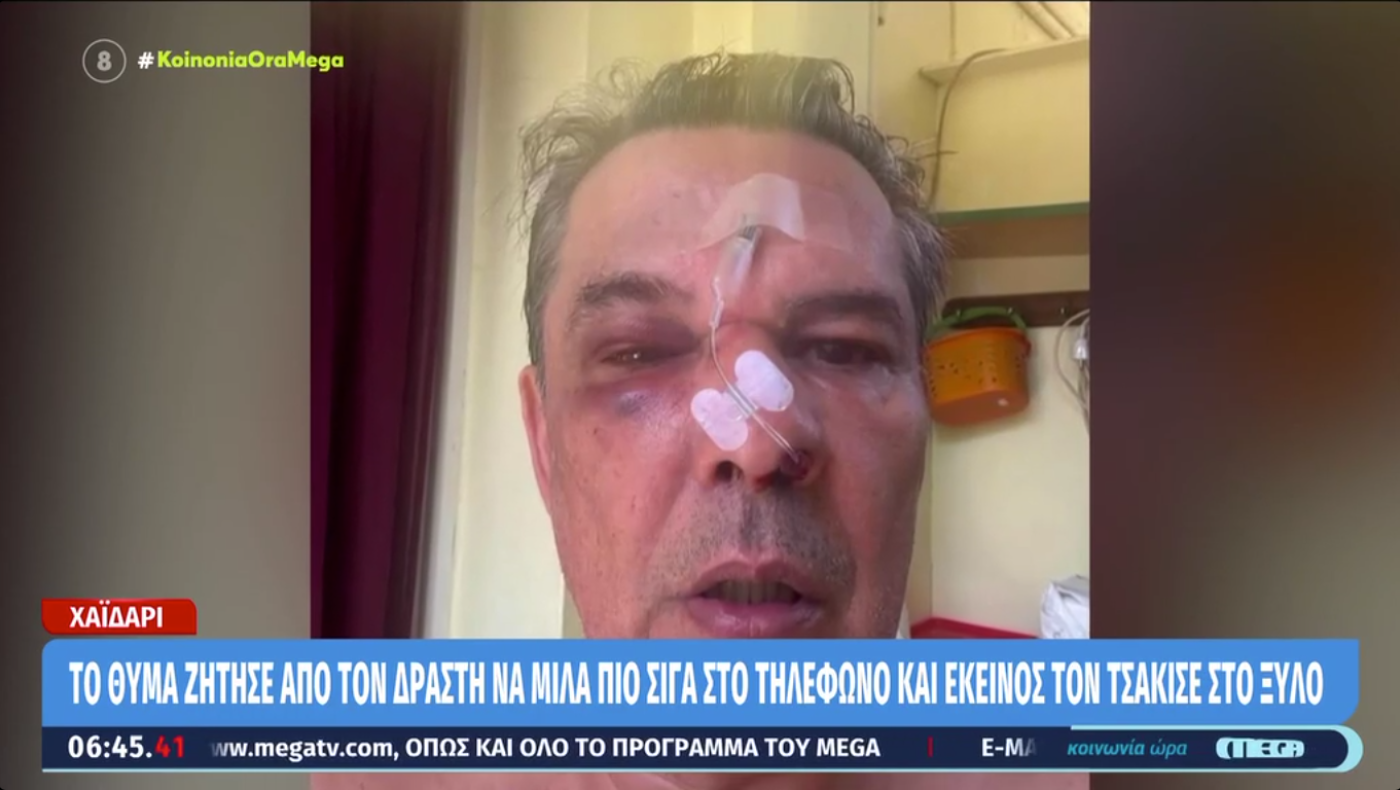 Χαϊδάρι: Τον «έσπασε» στο ξύλο γιατί του ζήτησε να μιλά σιγότερα
