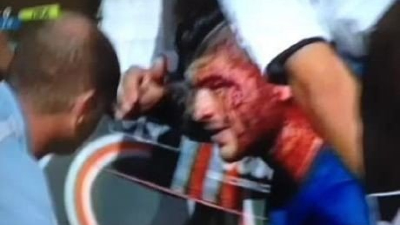 Ο σοκαριστικός τραυματισμός του Ζιαμπάρη (videos)