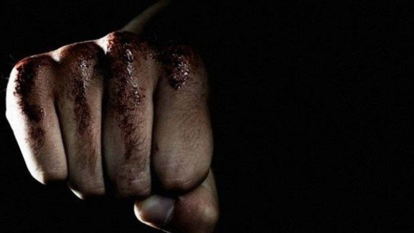 ΣΟΚ στη Σπάρτη: Γρονθοκόπησαν μέχρι θανάτου ιδιοκτήτη μπαρ (ΦΩΤΟ)