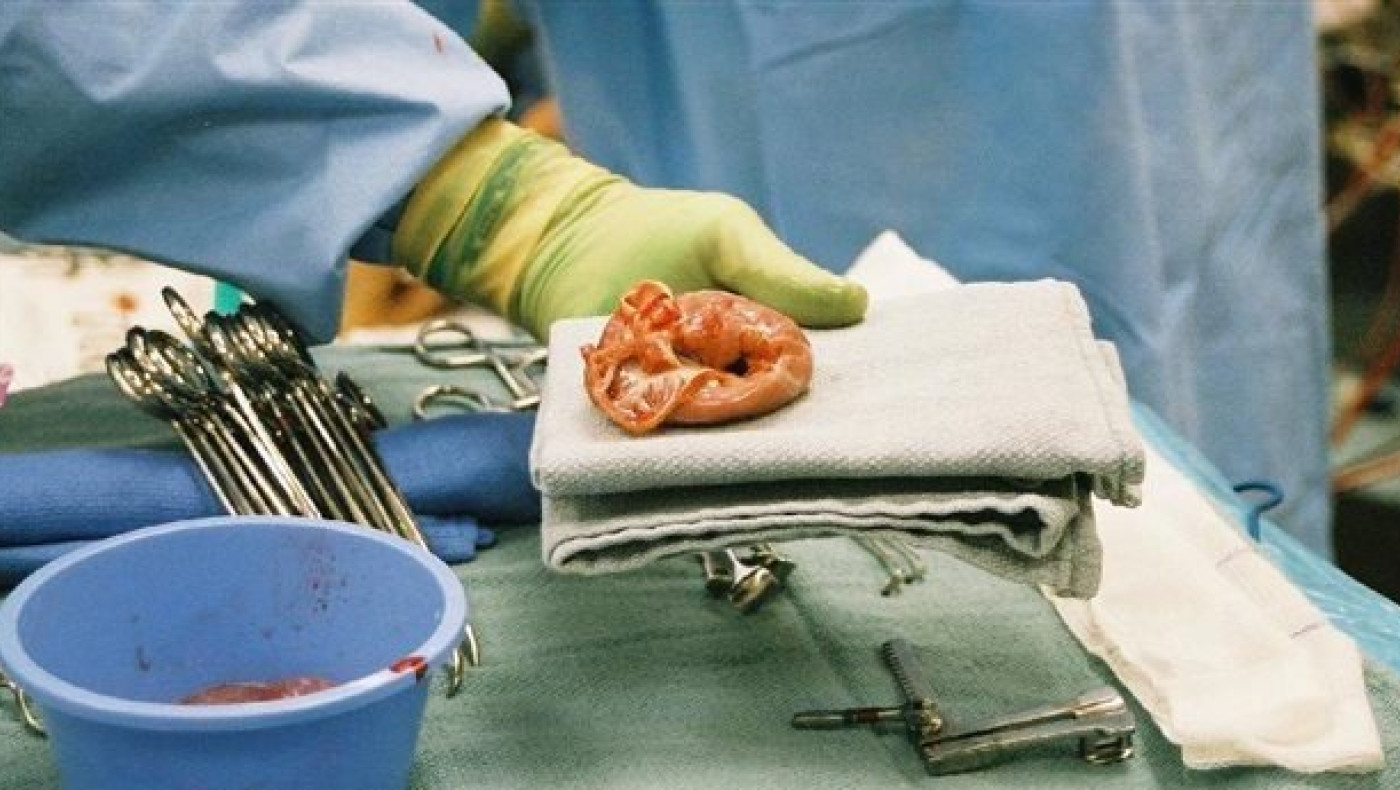 Πραγματικότητα η πρώτη μεταμόσχευση «νεκρής» καρδιάς