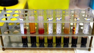 Σμηνίτης μπήκε καραντίνα με λάθος δείγμα στη Ρόδο