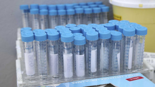 ΣΟΚ: 1259 νέα κρούσματα, 102 οι διασωληνωμένοι!