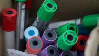 Θεσσαλονίκη: Τέσσερα Κέντρα Υγείας επιστρατεύονται στη μάχη κατά του κορωνοϊού