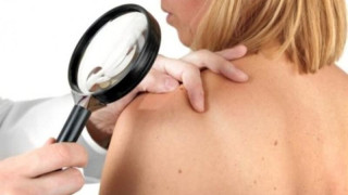 Θεσσαλονίκη: Προληπτικός έλεγχος για καρκίνο του δέρματος, χοληστερόλη κ.α