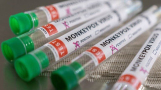 Μόσιαλος για κρούσμα ευλογιάς τον πιθήκων: Ελάχιστος κίνδυνος για τον γενικό πληθυσμό