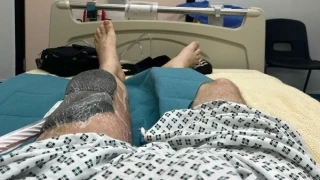 DJ έγδαρε το γόνατό του και κόντεψε να πεθάνει - H λοίμωξη που του «έτρωγε» τη σάρκα