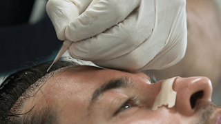 Έχεις τριχόπτωση; Έχουμε τη λύση