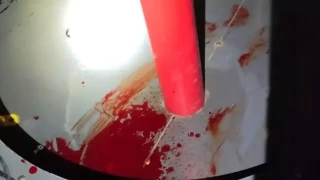 Σοκαριστικό ατύχημα σε παιδική χαρά στην Αλεξανδρούπολη