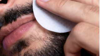 Αυτοκτόνησε μετά από μεταμόσχευση γενειάδας στην Τουρκία!