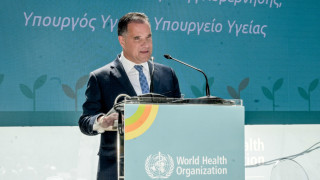 Γεωργιάδης για μεταμόσχευση μαλλιών: «Πόσο πολύ ασχολούνται με τις τρίχες μου»