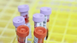 Αν έχουμε αυτή την ομάδα αίματος, είναι πιθανότερο να διατηρηθούμε νέοι για περισσότερα χρόνια