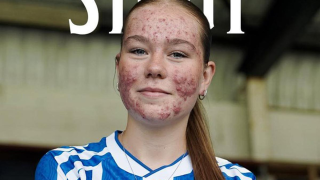 Γιατί είμαστε με τη Σκάι Στάουτ: Η αθλήτρια που δέχθηκε bullying για την... ακμή της