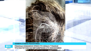 Θεσσαλονίκη: Της ήρθε πινακίδα στο κεφάλι ενώ περπατούσε στο πάρκο Ξαρχάκου