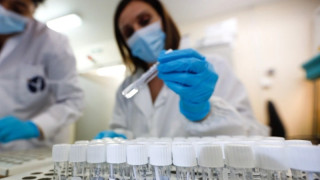 Έλληνες ανακάλυψαν to νέο ένζυμο αντιγήρανσης-Πώς λειτουργεί ο μηχανισμός