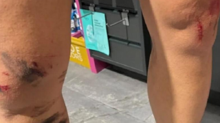 Κρυονέρι: Καταγγελία άνδρα ότι δέχθηκε επίθεση από λύκο – «Πάλευα μαζί του για οκτώ λεπτά»