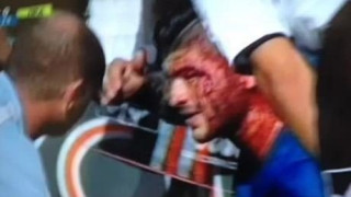 Ο σοκαριστικός τραυματισμός του Ζιαμπάρη (videos)