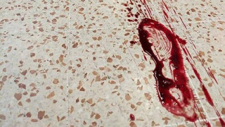 Γιατρός ακολουθεί αιματοβαμμένες πατημασιές & βρίσκει κάτι τρομακτικό