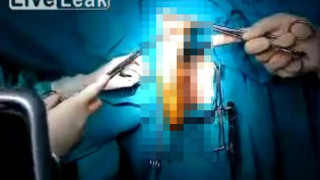 Επαιζε με sex toys και κατέληξε στο νοσοκομείο