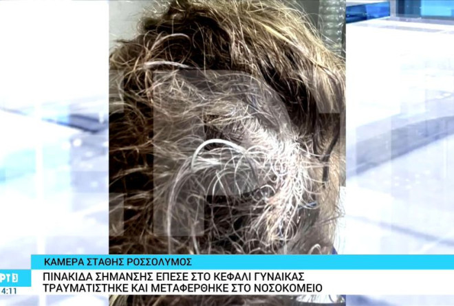 Θεσσαλονίκη: Της ήρθε πινακίδα στο κεφάλι ενώ περπατούσε στο πάρκο Ξαρχάκου