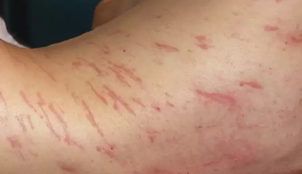 A generic square placeholder image with rounded corners in a figure.