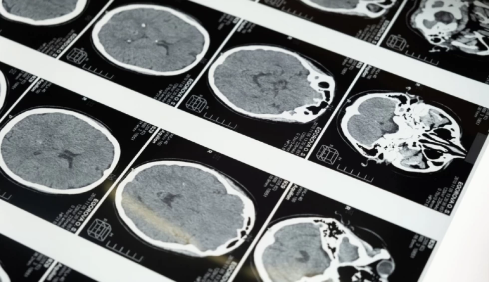 A generic square placeholder image with rounded corners in a figure.